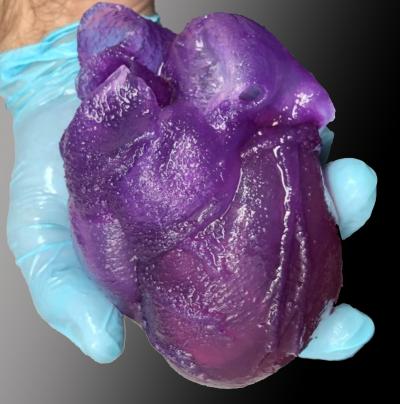 Corazón realista bioimpreso FRESH podría ayudar a la simulación y al entrenamiento quirúrgico