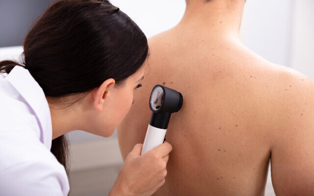 Tecnología israelí dice que da un diagnóstico de cáncer de piel preciso y sin cortes, en segundos