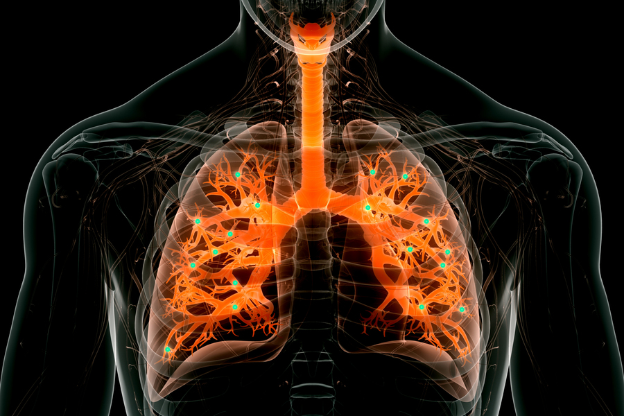 Las nuevas nanopartículas pueden realizar la edición de genes en los pulmones