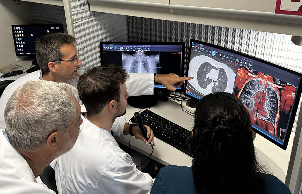 Fundación Philips y Fundación FUCA lideran iniciativa de teleradiología para la detección temprana del cáncer de pulmón en regiones remotas de Argentina