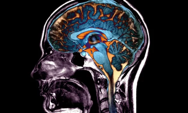 Cinco formas en que el cerebro puede envejecer: 50.000 escáneres revelan posibles patrones de daño