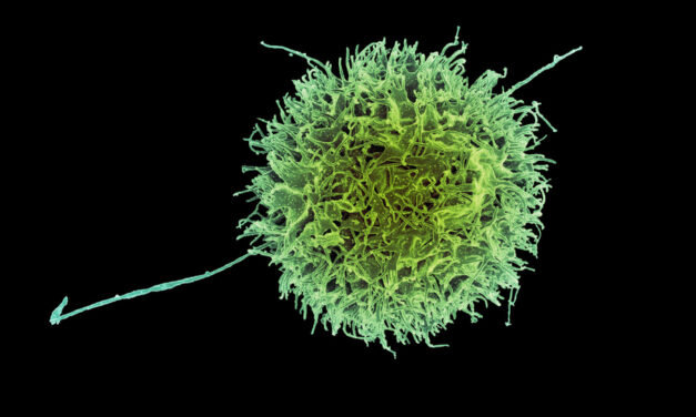 Las células “asesinas naturales” diseñadas podrían ayudar a combatir el cáncer