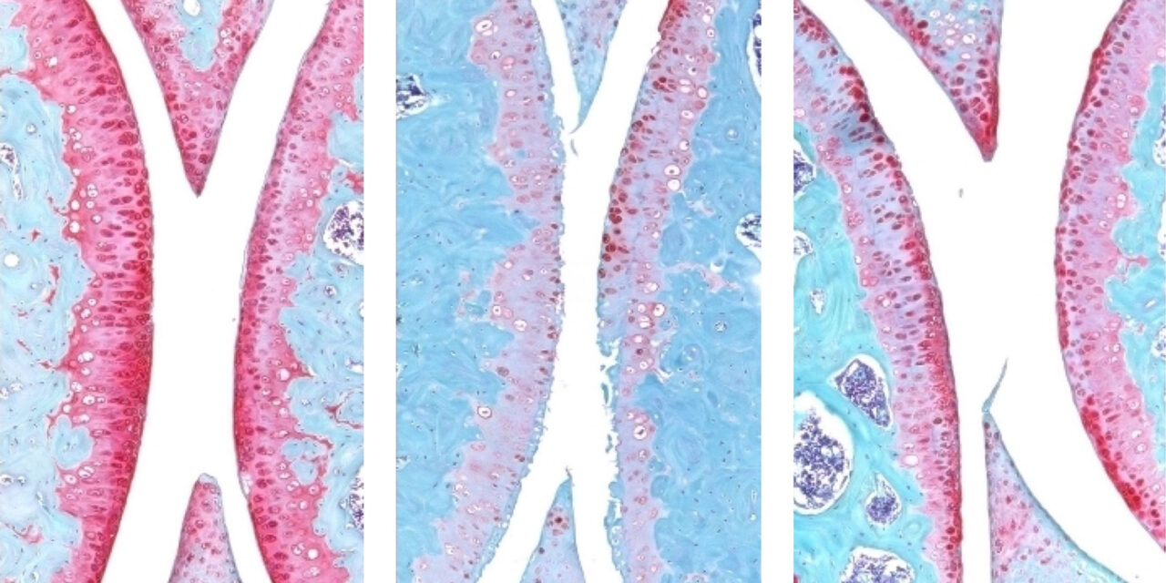 El bloqueo de un regulador maestro del envejecimiento regenera el cartílago articular en ratones