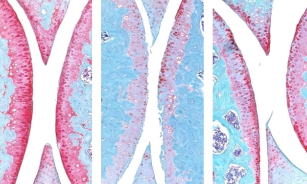 El bloqueo de un regulador maestro del envejecimiento regenera el cartílago articular en ratones